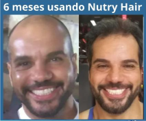 3 meses usando Nutry Hair (1)